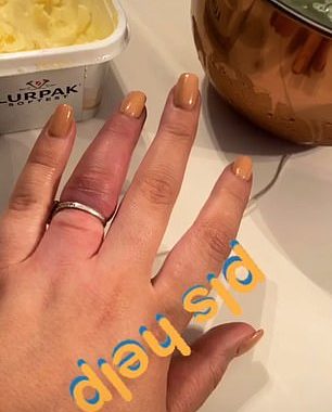 England keeper Jordan Pickford’s pregnant fiancée shares pain of having ‘£500,000’ diamond engagement ring cut off after asking for ‘old wives tales’ to help free it from her swollen finger