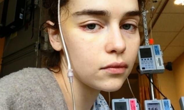 Emilia Clarke shares never-before-seen images from her hospitalisation with a brain aneurysm and reveals the impact it had on her mental health