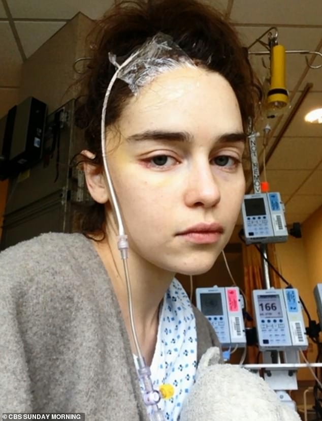 Shocking- Emilia Clarke has released unseen photographs taken during her recovery from a life-threatening brain aneurysm in 2011, when she was just 24 years old